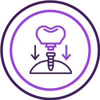 Natural Look and Feel