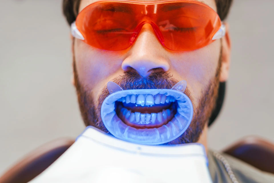 Brighten Your Smile with Teeth Whitening in Alliston