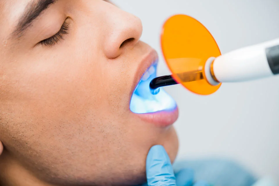 Teeth Whitening Treatments 1 Types of Teeth Whitening Treatments