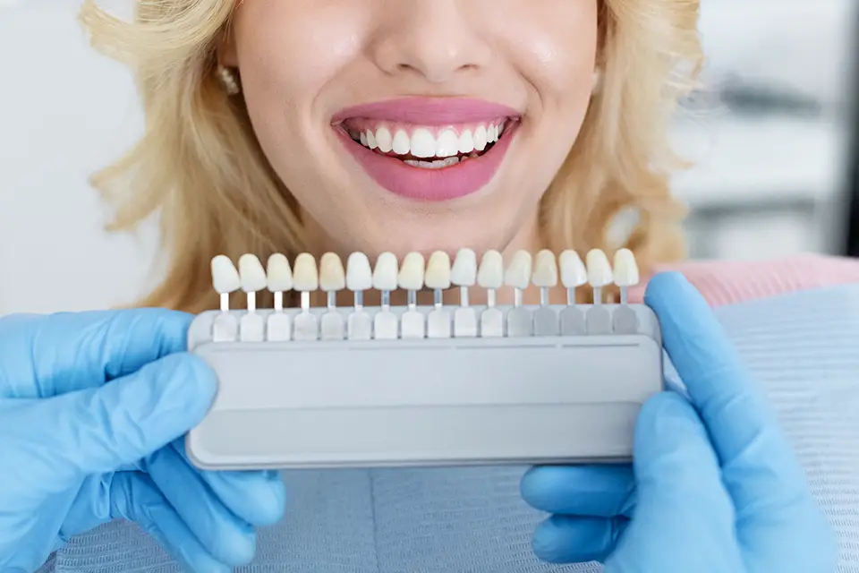 Teeth Whitening vs Veneers: Which Is Right for You?