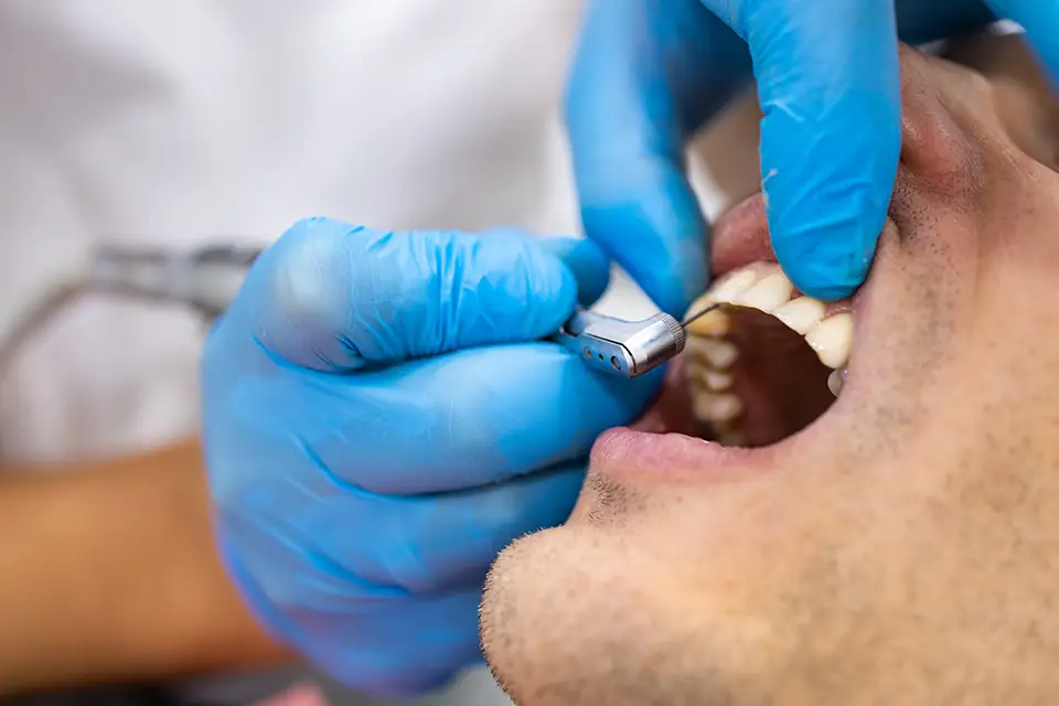 Reliable Tooth Filling Services in Alliston