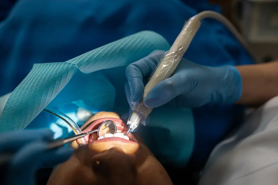 Painless Root Canal Treatment in Alliston: Cost of a Root Canal in Ontario