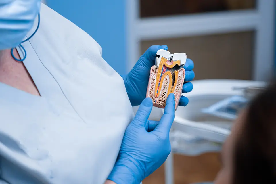 Emergency Root Canal Dentist Alliston: Saving the Tooth vs Extraction