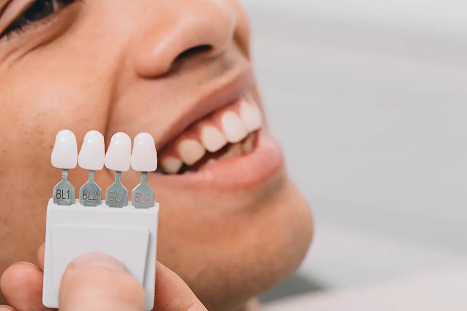 Affordable Teeth Whitening Alliston – Shine Brighter for Less