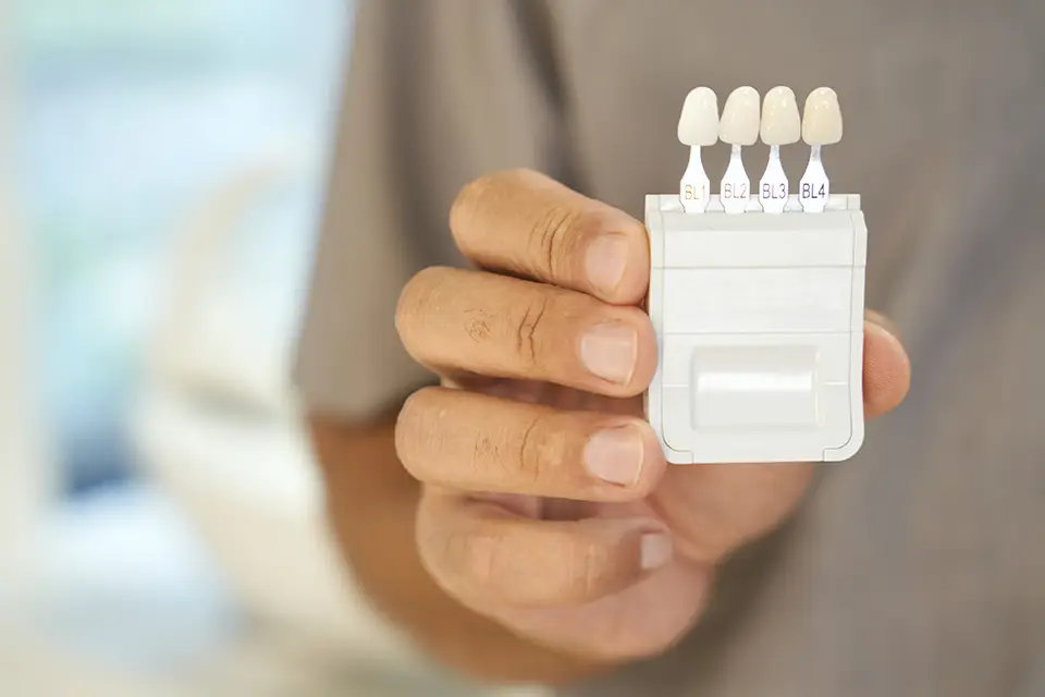 Porcelain Veneers in Alliston – Instantly Improve Your Smile