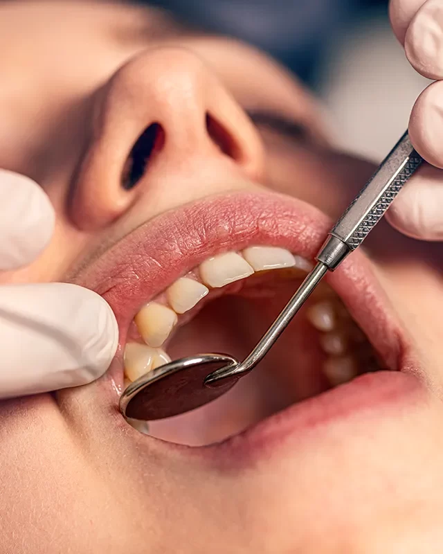 Dental Extractions - kingdentalcentre