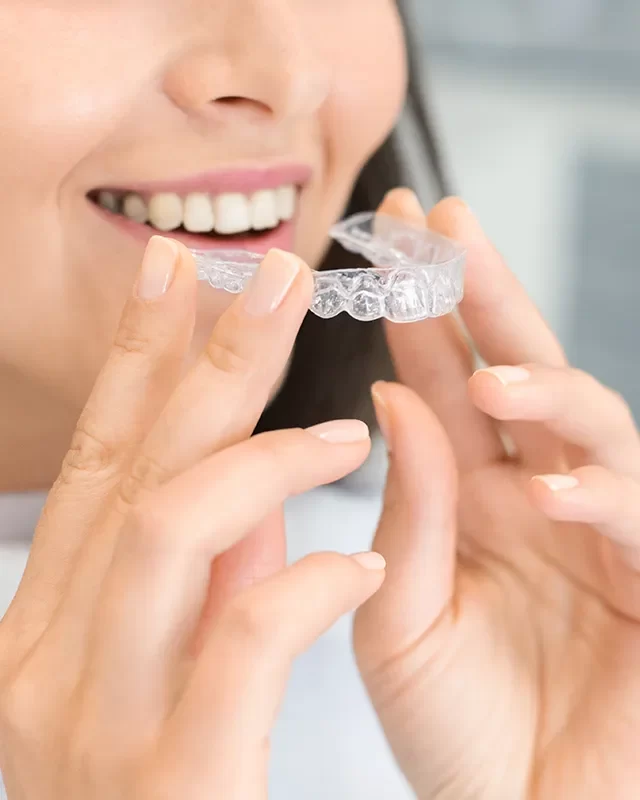 Invisalign - kingdentalcentre