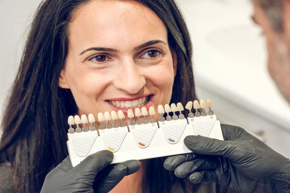 Porcelain veneers for front teeth The Process: Porcelain Veneers for Front Teeth