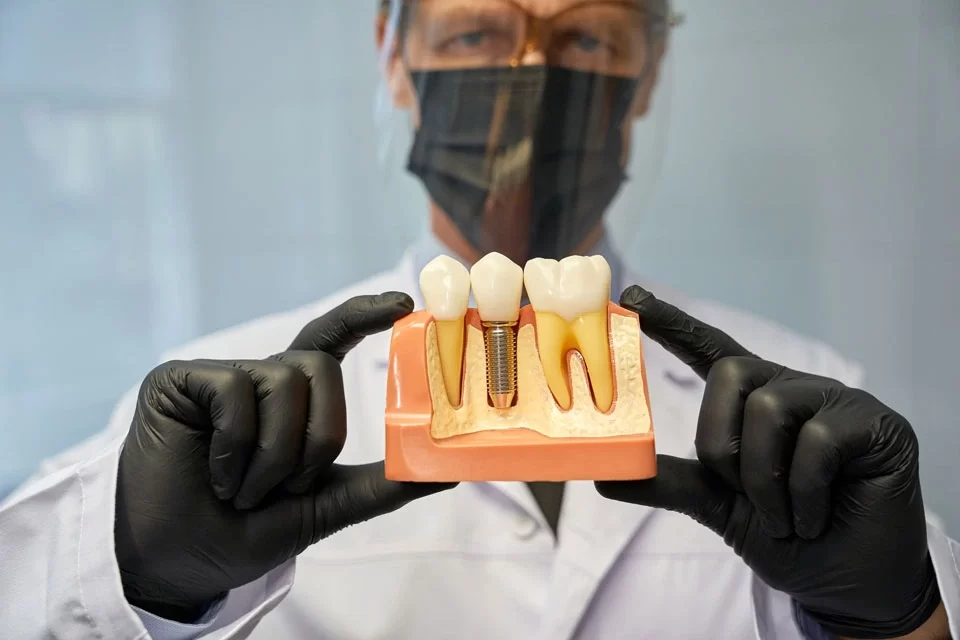 Dental Visit Implants Benefits of Dental Implants