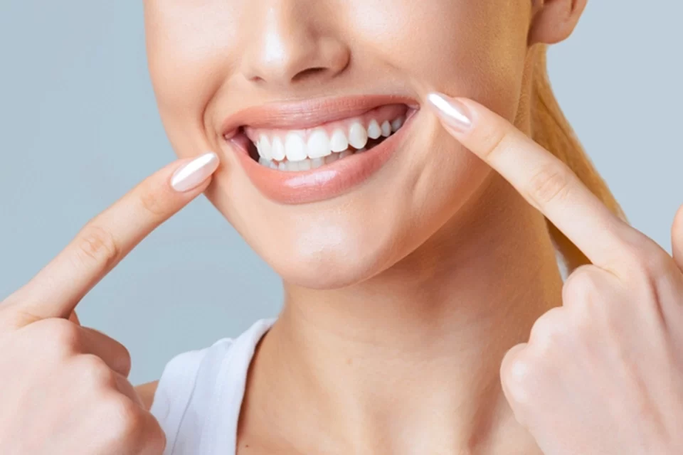 Whitening Treatment The Teeth Whitening Process at King Dental Centre