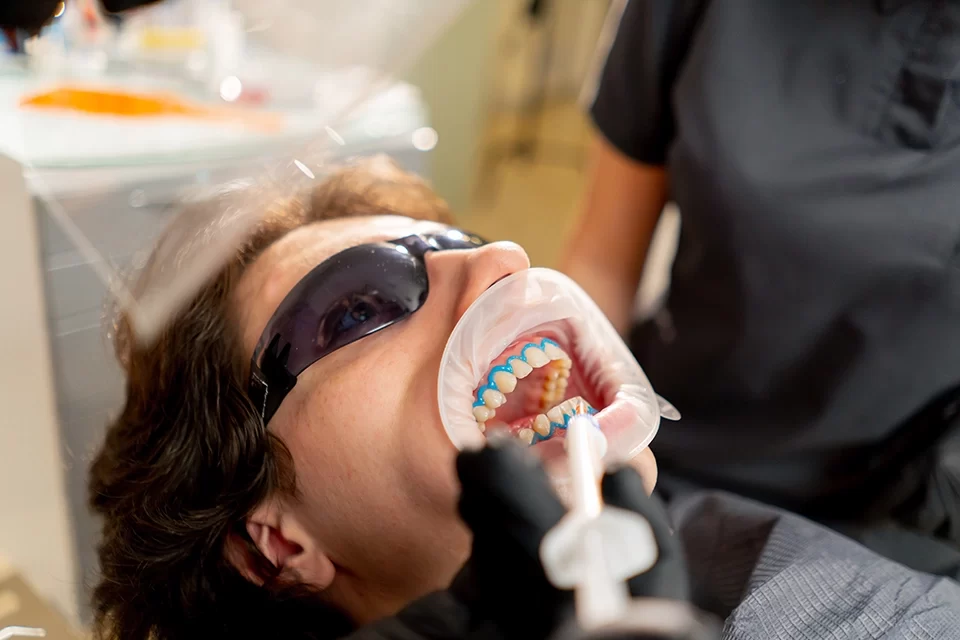 Whitening Treatment How Professional Teeth Whitening Works