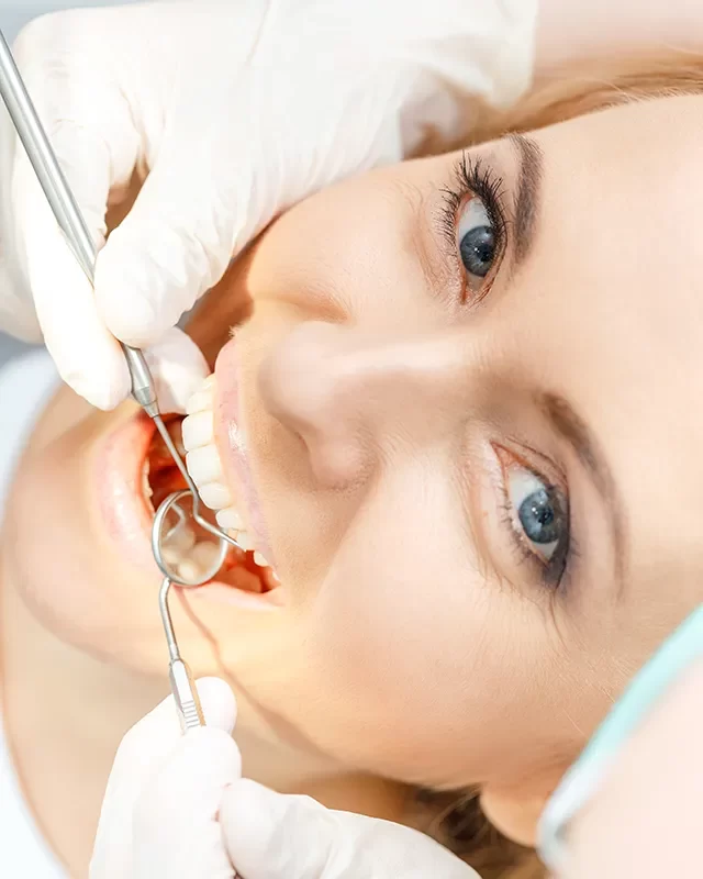 Wisdom Teeth Removal - kingdentalcentre
