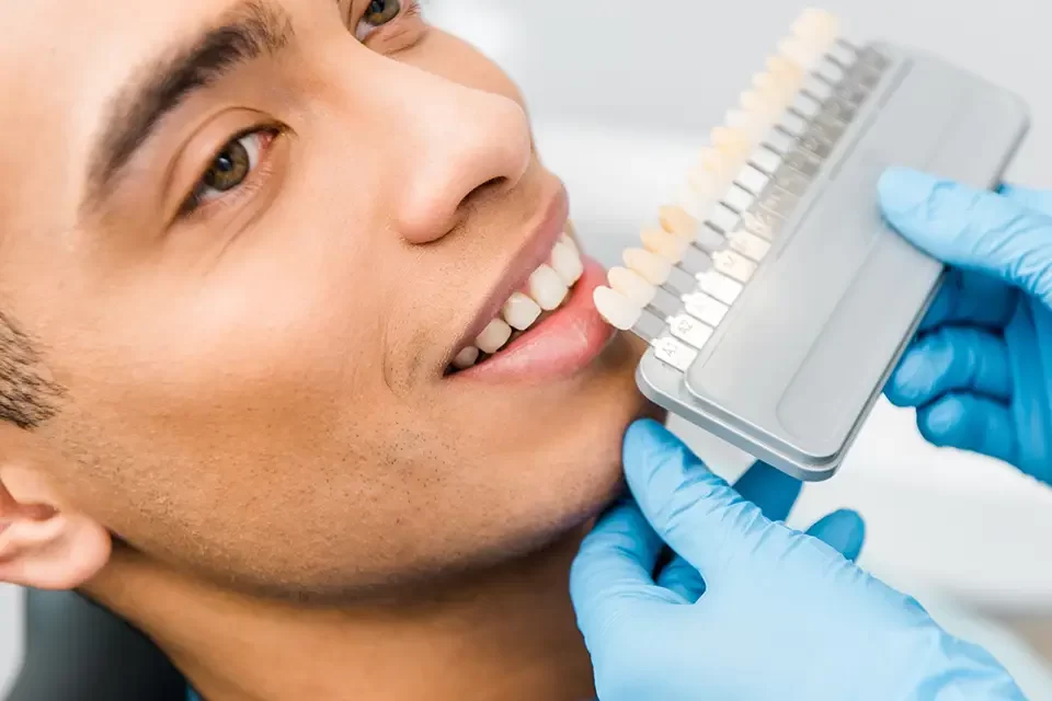 dental bonding Benefits of Cosmetic Dental Bonding for Gaps