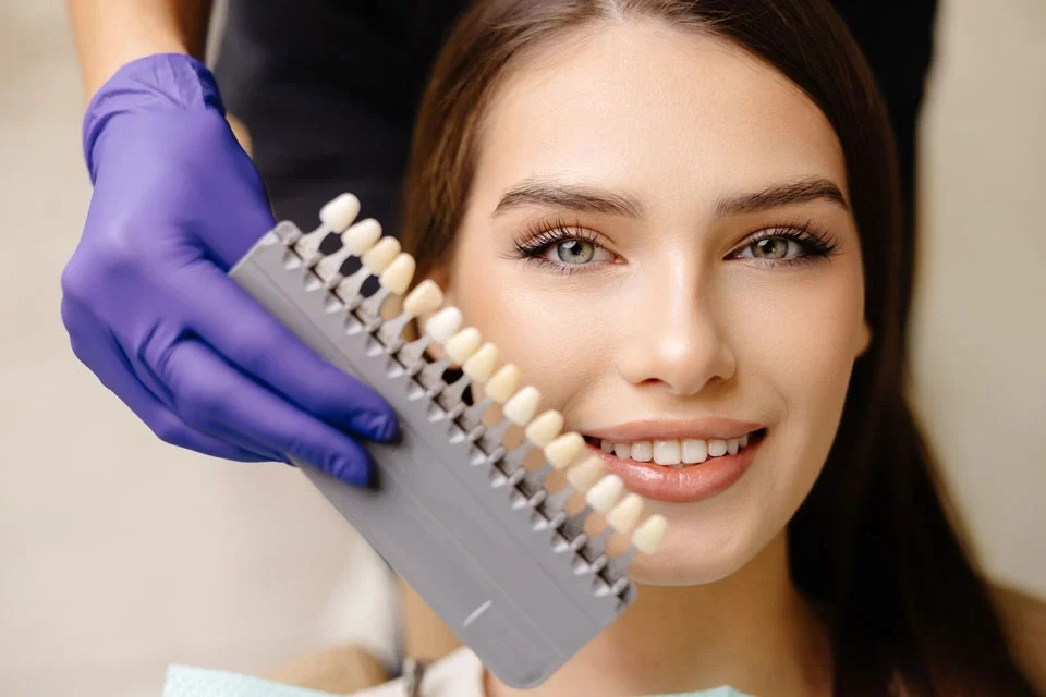 Veneers The Average Cost of Dental Veneers