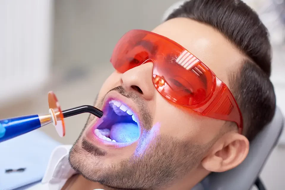 Benefits of Laser Treatment for Gummy Smile