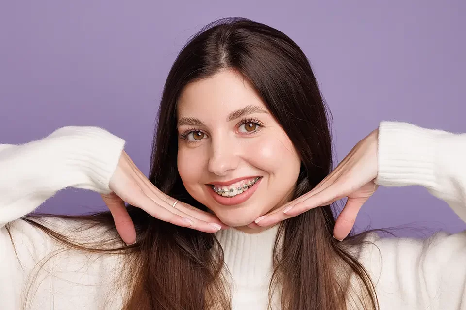 Exploring Your Options for Cosmetic Braces for Teens